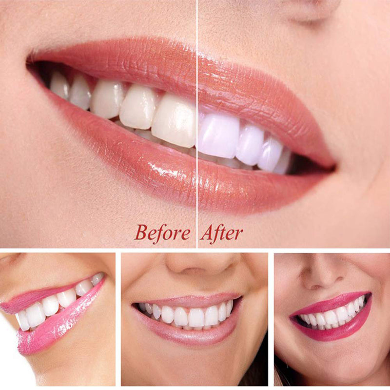 Teeth Whitening Serum Gel