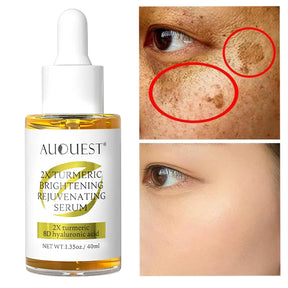 Dark Spot Serum