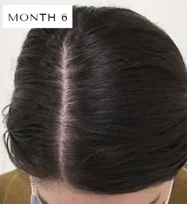 RED LIGHT THERAPY BRUSH SCALP MASSAGER COMB HAIR GROWTH ANTI HAIR LOSS