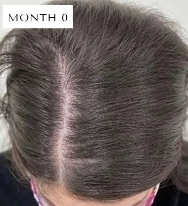 RED LIGHT THERAPY BRUSH SCALP MASSAGER COMB HAIR GROWTH ANTI HAIR LOSS